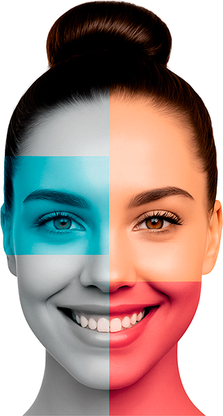 Blanqueamiento dental Smile Flash